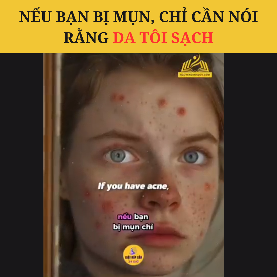 Nếu bạn bị mụn, chỉ cần nói rằng da tôi sạch